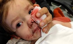 2 kardeşe saldıran pitbull ile ilgili 12 şikayet yapılmış