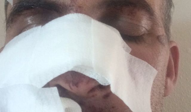 Eniştesine araçla çarpıp kaçtı; o anlar kamerada