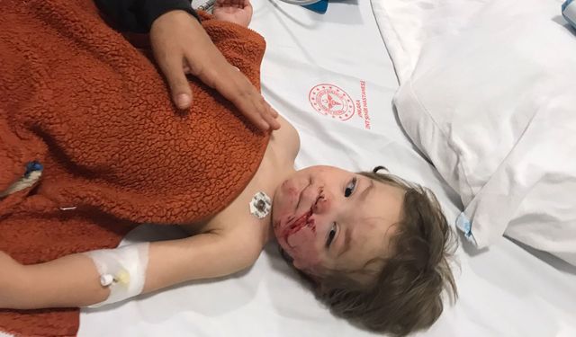 Ankara'da pitbull saldırısına uğrayan 1,5 ve 5 yaşındaki kardeşler yaralandı (2)- Yeniden