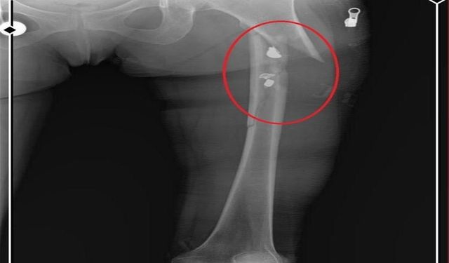 Arkadaşını öldürüp, yaraladığı sevgilisini 21 gün boyunca evinde tutan sanık için müebbet istemi