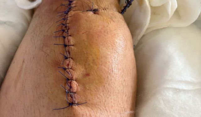 Evinin önünde silahlı saldırıya uğrayan iş insanı: Can güvenliğim yok