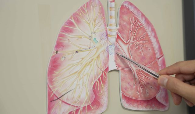 'KOAH hastalarında risk kış aylarında daha da artıyor'