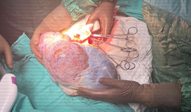 Ordu'da hastanın karnından 5 kiloluk kitle çıkarıldı