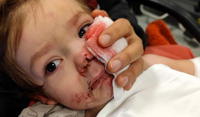 2 kardeşe saldıran pitbull ile ilgili 12 şikayet yapılmış